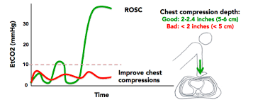 False positive co2 detection — oesophageal intubations after consumption of carbonated beverages or vigorous bag and mask ventilation (although this theatres) — colorimetric co2 detectors may change colour if exposed to acidic fluid (e.g. End Tidal Co2 In Cardiopulmonary Resuscitation Etco2 In Cpr