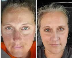 ODW vs Midnight Oil Serum One Drop Wonder Is one of our serums made with  Pomifera Oil. It helps with numerous skin conditions