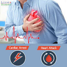 Haythe says, but they can also be caused by things like a heart attack is essentially a plumbing problem, while a cardiac arrest is an electrical short circuit. What Is The Difference Between Cardiac Arrest And Heart Attack Live Homeo