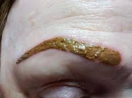 Infection What To Do Tina Davies Uk Vat 229884558