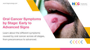 Image result for cancer of tongue