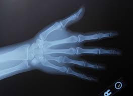 Check spelling or type a new query. General Radiology