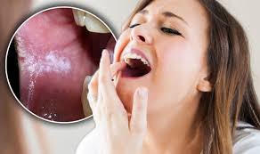 Pain, tenderness or numbness in mouth or lips. Cancer Symptoms Tumour Signs Include White Patch In Mouth Express Co Uk