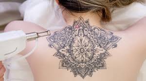 This involves having the tattoo surgically removed using a scalpel. Why Getting A Tattoo Removed Is Riskier Than You Think