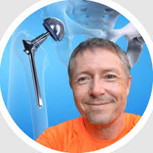 Should I see an orthopedic surgeon for hip pain and how will it affect my  ability to teach yoga?