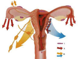 Die wucherungen sind zwar gutartig. Was Ist Endometriose Stiftung Endometriose Forschung