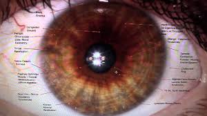 iridology reading part i