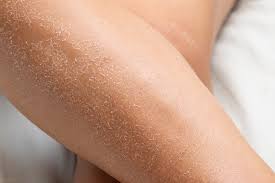 Image result for Dry Skin