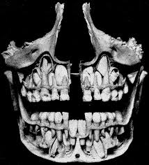 deciduous teeth wikipedia