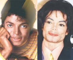 Surge in plastic surgery among minorities