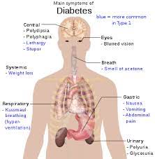 Gestational diabetes (diabetes during pregnancy) usually doesn't have any symptoms. Diabetes Wikipedia