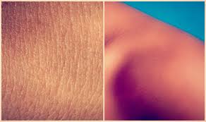 Diameter moles usually stay within. Skin Color Protein Used To Better Evaluate Skin Cancer Cancer