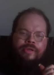 Can anyone else spot the rather grumpy face in my bruise ? Kinda reminds me  of a blobfish 🙃 😅