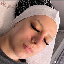 Reviews of Syree Aesthetics