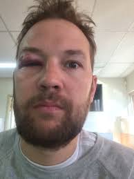 A Black Eye for the Industry