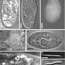 Different paramecia infected with Holospora bacteria. a Paramecium... | Download Scientific Diagram