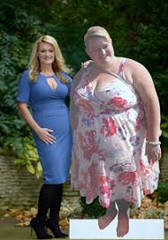 Obezitatea instalata devreme, in copilarie, creste riscul de obezitate morbida la maturitate, de aceea. De La Obeza A Ajuns Miss Divahair Ro