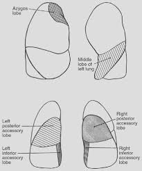 Surgical Anatomy Of The Lungs Thoracic Key
