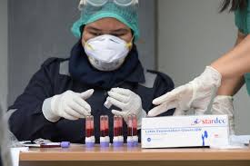 Mengapa Rapid Test Corona Bisa Negatif Palsu Sedangkan Pcr Butuh 3 Hari Halaman All Kompas Com