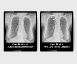 Digital Radiography Gr40cw Samsung Healthcare Global