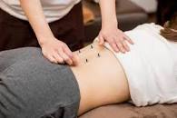 灸の写真素材｜写真素材なら「写真AC」無料（フリー）ダウンロードOK