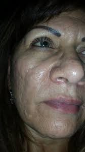 Melissa A. Bogle, MD, Board Certified Dermatologist