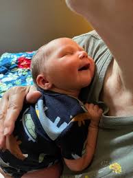 Do ultrasound pictures always accurately represent how babies will look?