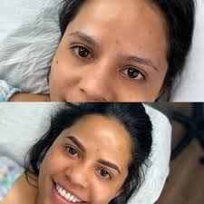 Permanent makeup treatments available : 🔆lip blush 🔆powder-brows 🔆PMU  corrections , color boosts( if possible to fix ) 🔆languages- English , ,  Latvian , Russian More in Facebook page