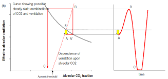 Image result for Cheyne-Stokes Respiration