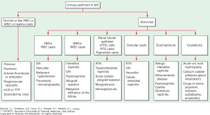 Acute Kidney Injury Harrisons Principles Of Internal