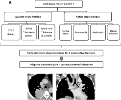 Symptoms to know about stage 4 lung cancer. Adaptive Radiotherapy For Advanced Lung Cancer Ensures Target Coverage And Decreases Lung Dose Radiotherapy And Oncology