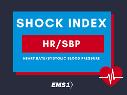 Image result for Shock Index
