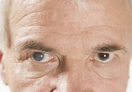 سوالات پیرامون علل خشکی چشم و عوامل خطر - چشم پزشکی نوآوران