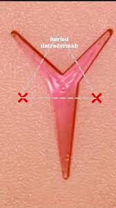 Image result for Corner Stitch