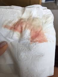 While pregnant you will often have mucusy discharge, but the mucus plug looks a little different. Red Bleeding At 12 Weeks Pregnant