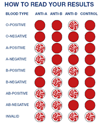 Blood Transfusion Chart Google Medical Laboratory