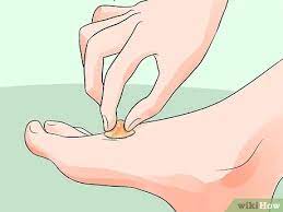Eine Blase Aufstechen 14 Schritte Mit Bildern Wikihow