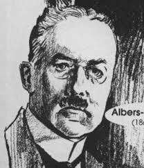 A BRIEF HISTORY OF THE ANTEROPOSTERIOR OPEN-MOUTH RADIOGRAPH