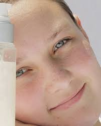 Teen Beauty is Soaring, But Don't Underestimate the Risk