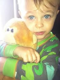 Washington Township 2-year-old Damian Sutton recovering after emergency  skull surgery