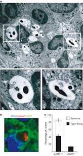 Start studying tissues under the microscope. Listeriolysin O Allows Listeria Monocytogenes Replication In Macrophage Vacuoles Nature