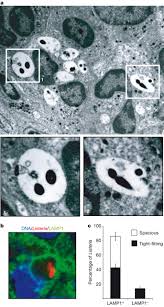 When looking at bacteria under the microscope much of the bacteria can appear transparent without staining. Listeriolysin O Allows Listeria Monocytogenes Replication In Macrophage Vacuoles Nature