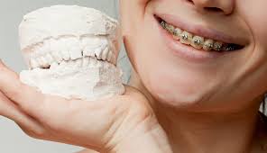 When it comes to correcting and managing an underbite there are plenty of. Correcting An Over Or Underbite Ismile Orthodontics