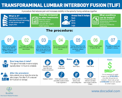 Lumbar Spinal Fusion Gaurav Abbi