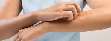 Spiritual and relaxation practices like yoga and meditation can really help your body to deal with and eliminate these stresses. Can Yoga Really Help Treat Skin Allergies Allergy