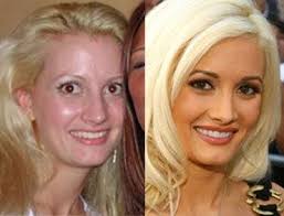 Holly madison is lovely as a man with an unmistakable appearance and a delightful body to investigate holly madison's nose work prior and then afterward photographs and you'll read the. Plastic Surgery Celebrity Plastic Surgery Nose Job