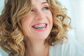 How much does it cost to get orthodontic braces? How Much Does Braces Cost Hunter Valley Orthodontics