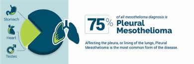 The prognosis for pleural mesothelioma is favorable for patients diagnosed in an early stage and unfavorable for those diagnosed at a late stage . Pleural Mesothelioma Diagnosis Treatment And Life Expectancy