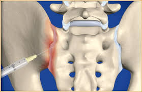 Image result for Joint Injection