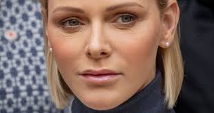 Princess charlene of monaco said she is in a waiting game to be alongside her family again. Charlene De Monaco Suffering She Has To Undergo A New Serious Operation